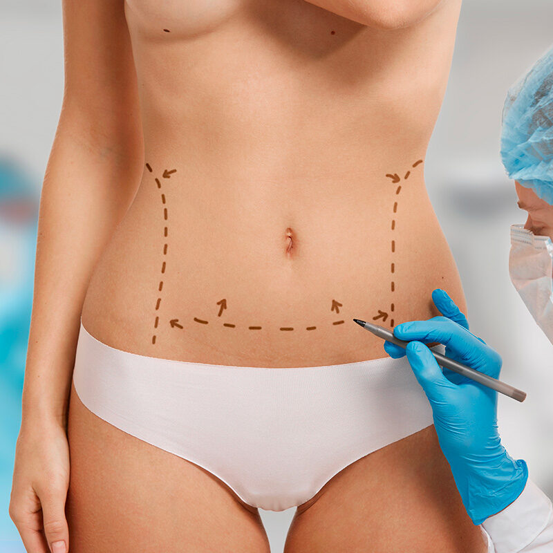Chirurgia corpo